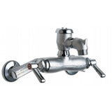 Chicago Faucets 305-VBRXKRCF Universal Wall Mounted Service Sink with Adjustable Centers Polished Chrome - Chicago Faucets